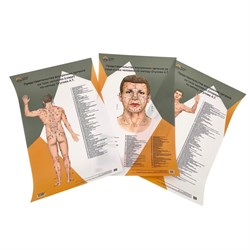 Комплект 3 шт. пластиковых плакатов А3 Представительство внутренних органов на лице, шее и теле по Огулову А.Т. вид спереди и сзади - фото 4785